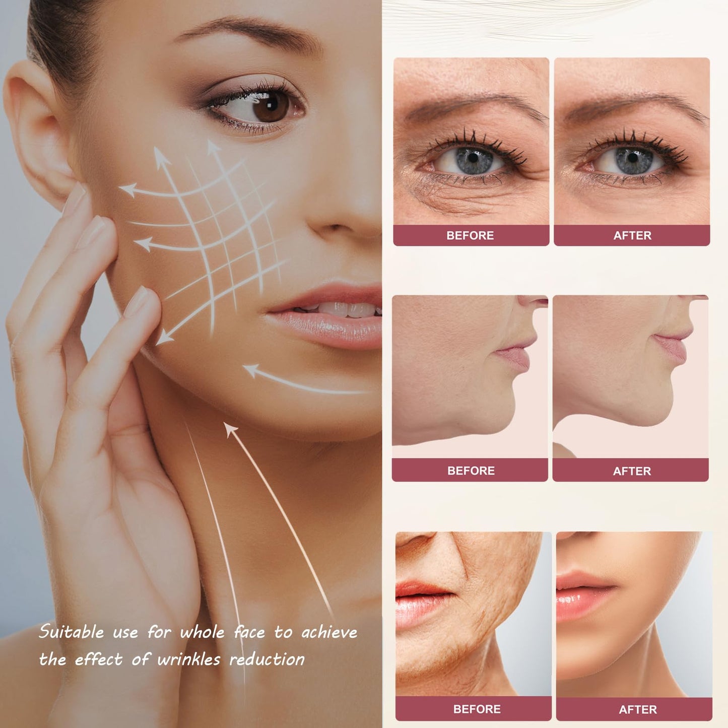MZONG Non - Wireless RF Skin Rejuvenator - LED Light Combo for Face & Body Wrinkle Reduction