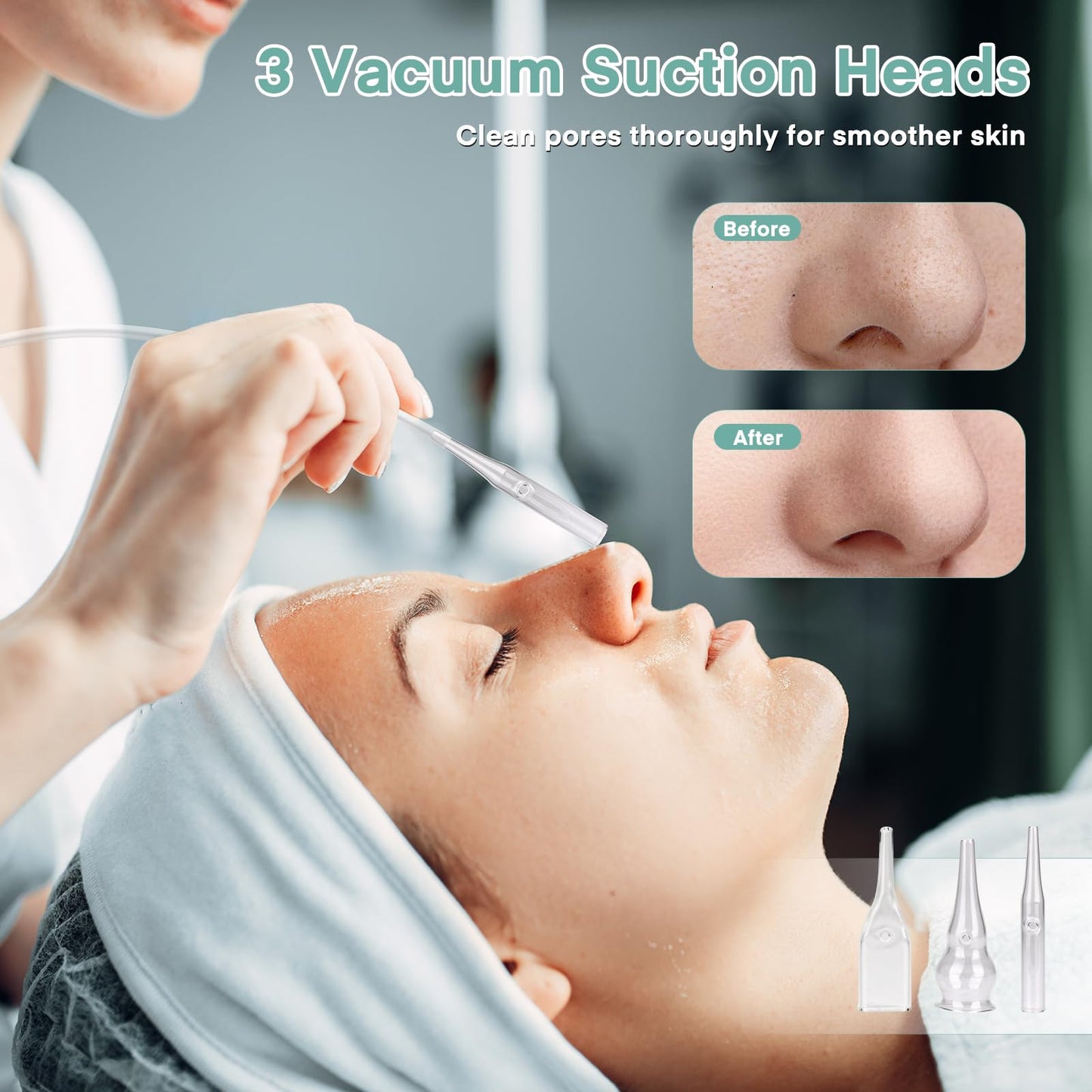 Professional Diamond Micro-dermabrasion Machine, Yofuly Diamond Micro-dermabrasion Dermabrasion Equipment Facial Peeling Spa(0-68cmHg)